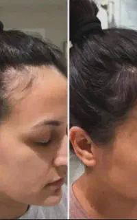 با کچلی خدافظی کن