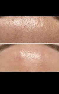 خدمات پلکسر  . به خاطر شرایط فعلی زیرقیمت همه جا