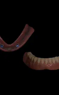 دندان سازی یک روزه یزدی با ضمانت