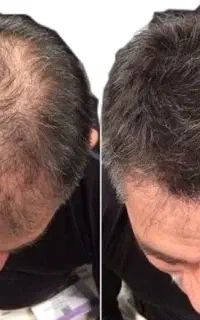 معجزه درمان موهات اینجاست