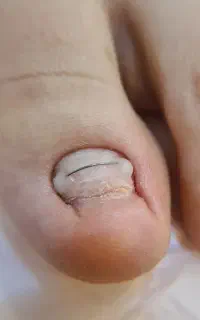 پودولوژی در ساری