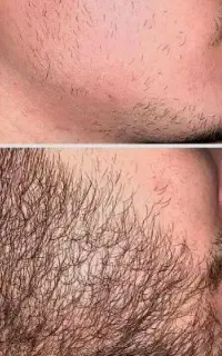 ریش بلند از ورزش هم مهم تره