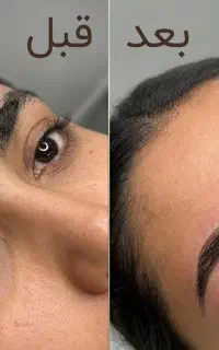 میکروبلیدینگ ابرو فقط با هزینه مواد(ظرفیت محدود)
