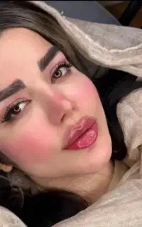 ژل گونه چونه زاویه خط خنده بوتاکس مزو آنزیم پرسینگ