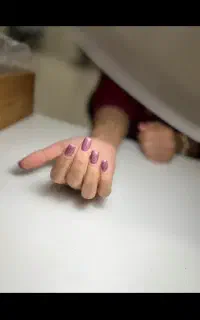 کاشت ناخن