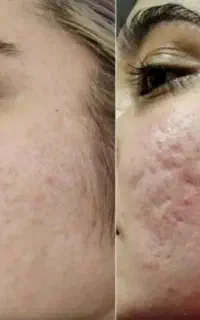 کرم ضدجوش عامل زیباییت/خرید درب خانه