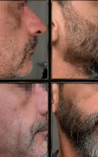 مسخرت میکنن چون ریش نداری