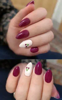 کاشت ناخن