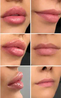 ژل لب روسی و نچرال ، بدون فرم مصنوعی و اردکی