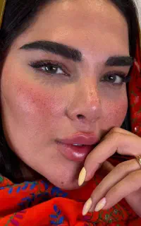 فیلرلب کلینیک مهرزاد-۵ میلیون تخفیف