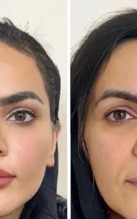 تخفیفات کلینیک زیبایی