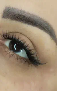 کاشت مژه هیدن موقت