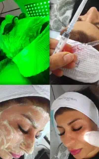 مدل فیشال و کاشت مژه
