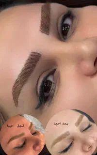 روشن سازی و احیای تتوهای تیره و بدرنگ