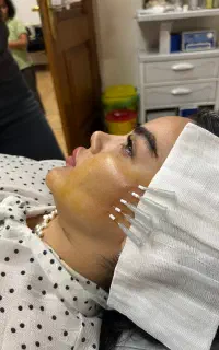 تخفیف ویژه در تمام لاینهای زیبایی