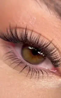 تخفیف اکستنشن کاشت لیفت