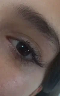کاشت مژه