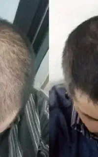 انقد سریع پرپشت میشه کلافه میشی