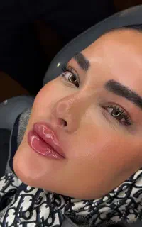 بوتاکس چشم گربه ای 500 ژل لب روسی عروسکی 500