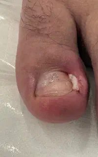 کلینیک درمان پا و ناخن