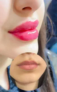 جشنواره آموزش فیشیال تخصصی کمترین قیمت درتبریز