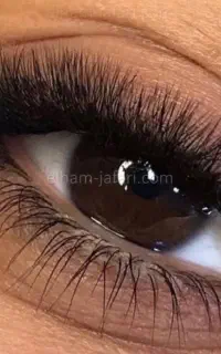 کاشت مژع