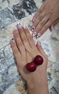 کاشت ناخن