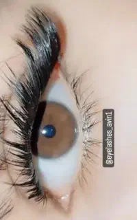 کاشت هیدن