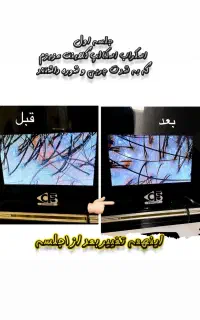 خدمات اسکراب اسکالپ سر