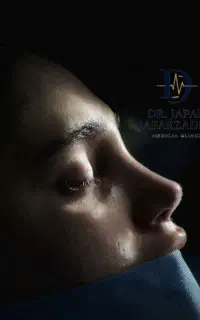ماموپلاستی و...