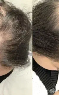 این اخرین روشیه که امتحان میکنی