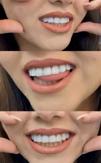 ارائه تمامی خدمات دندانپزشکی اقساطی/ویزیت رایگان