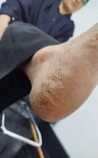 پدیکور پا و جوانسازی دست