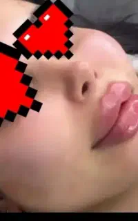 ژل لب و بوتاکس و مزو با کمترین قیمت