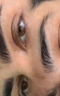 نانولیفت ابرو و رفع تیرگی لب به صورت تخصصی