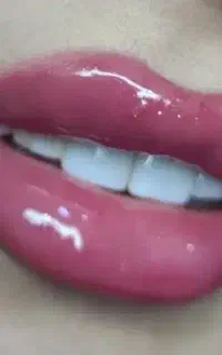 زیبایی ، ژل و بوتاکس و آموزش