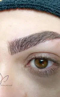 دکتر ابرو/ میکروبلیدینگ فیبروز / نمونه کارها واقعی