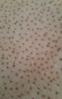 فروش  یونجه