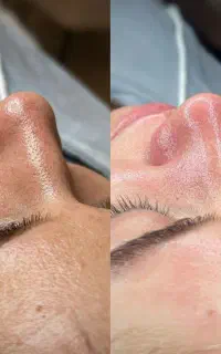 فشیال تخصصی و مشاوره پوست و مو