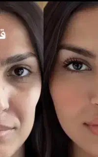 جشنواره تخفیفات پی آر پی مو و صورت و مزوتراپی