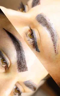 کاشت تخصصی ابرو