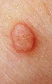 تماس بگیر درمان شو
