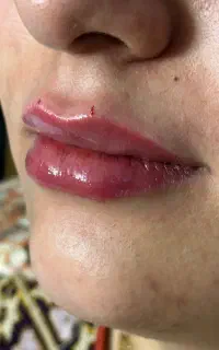 خدمات تخصصی زیبایی و جوانسازی و تزریقات