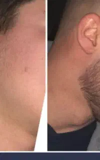 راز پر پشتی ریشات اینجاست