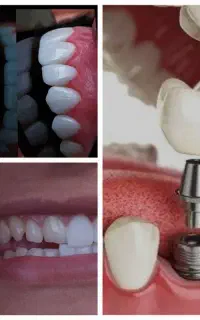 انجام تمام خدمات دندانپزشکی