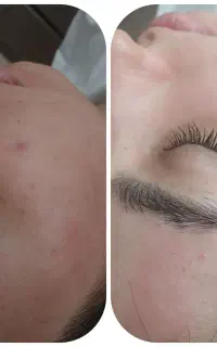 پاکسازی تخصصی پوست با دستگاه هیدرو فیشیال ۱۹۰ تومن
