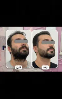 خدمات تخصصی زیبایی، مو و لاغری آقایان