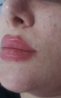 لاین فوق تخصصی و ویژه پوست