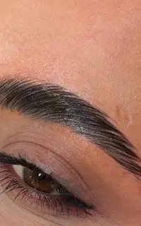 لیفت ابرو با قیمت مناسب /  زیبایی طبیعی چهره