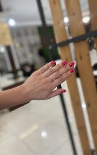 کاشت و ترمیم ناخن